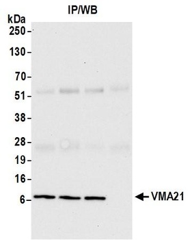 Rabbit anti-VMA21 Antibody
