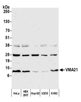 Rabbit anti-VMA21 Antibody