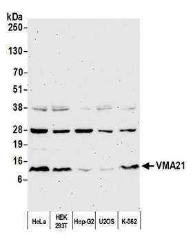 VMA21 Antibody