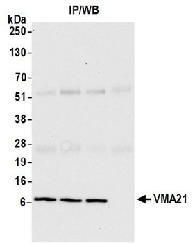 VMA21 Antibody