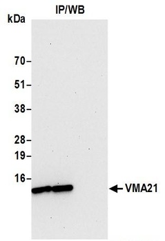 Rabbit anti-VMA21 Antibody