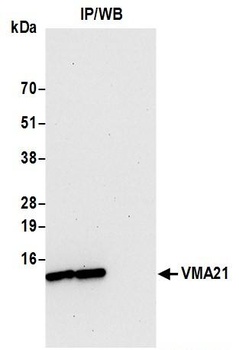 VMA21 Antibody