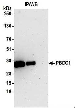 PBDC1 Antibody