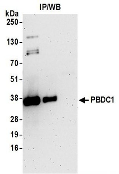 Rabbit anti-PBDC1 Antibody