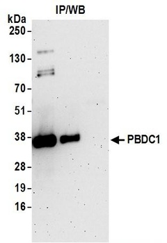 PBDC1 Antibody