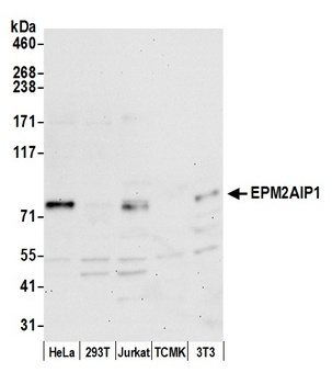 Rabbit EPM2AIP1 Antibody