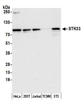 Rabbit STK33 Antibody
