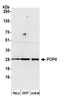 Rabbit POP4 Antibody