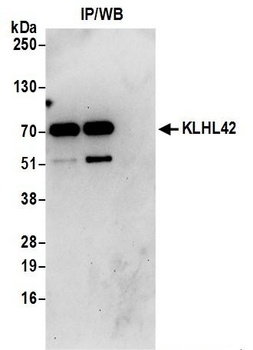 KLHL42 Antibody