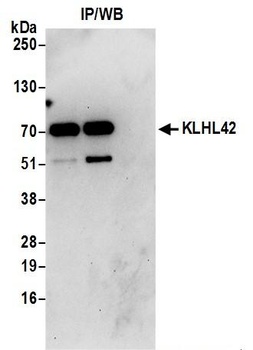 Rabbit anti-KLHL42 Antibody