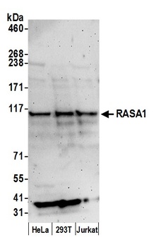 Rabbit RASA1 Antibody