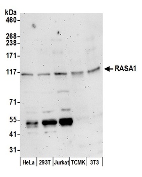 Rabbit RASA1 Antibody