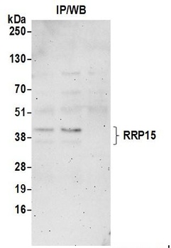 RRP15 Antibody