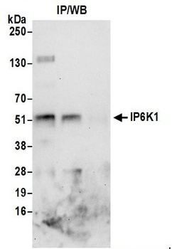 Rabbit anti-IP6K1 Antibody