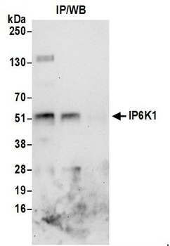 IP6K1 Antibody