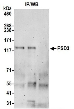 PSD3 Antibody