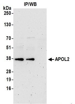APOL2 Antibody