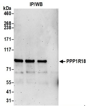 PPP1R18 Antibody