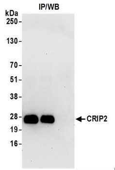 CRIP2 Antibody