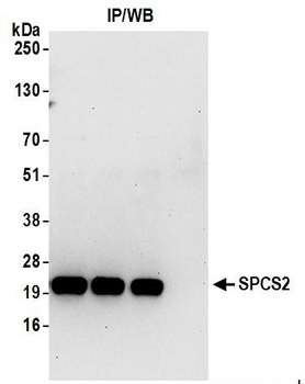 Rabbit anti-SPCS2 Antibody