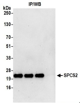 SPCS2 Antibody