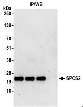 Rabbit anti-SPCS2 Antibody