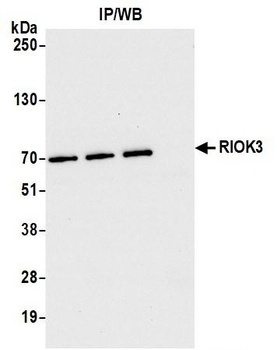 RIOK3 Antibody