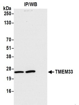 TMEM33 Antibody