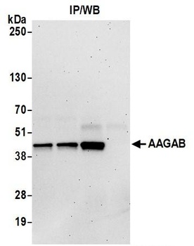 AAGAB Antibody