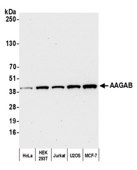 Rabbit anti-AAGAB Antibody