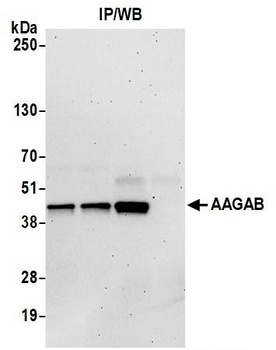 Rabbit anti-AAGAB Antibody