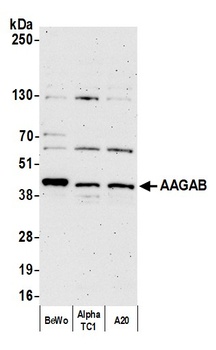 Rabbit anti-AAGAB Antibody