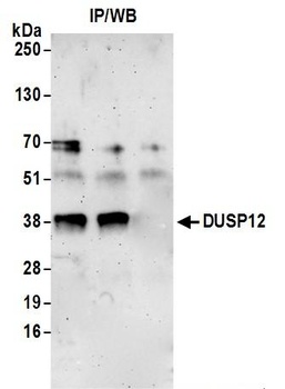 DUSP12 Antibody