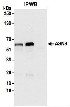 Rabbit ASNS/Asparagine Synthetase Antibody