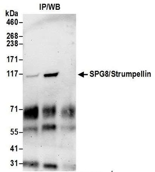 SPG8/Strumpellin Antibody