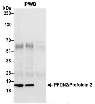 PFDN2/Prefoldin 2 Antibody