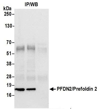 Rabbit anti-PFDN2/Prefoldin 2 Antibody