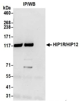 Rabbit anti-HIP1R/HIP12 Antibody