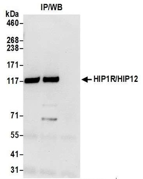 HIP1R/HIP12 Antibody