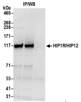 Rabbit anti-HIP1R/HIP12 Antibody