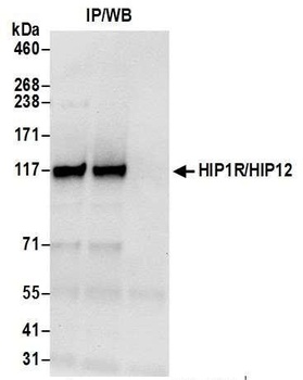 HIP1R/HIP12 Antibody