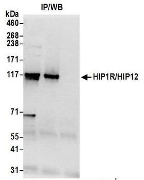 HIP1R/HIP12 Antibody