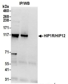 Rabbit anti-HIP1R/HIP12 Antibody