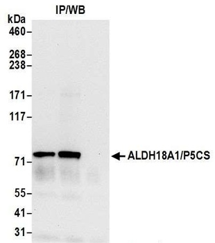 ALDH18A1/P5CS Antibody