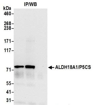 Rabbit anti-ALDH18A1/P5CS Antibody