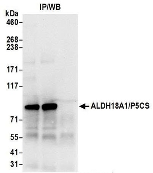 Rabbit anti-ALDH18A1/P5CS Antibody