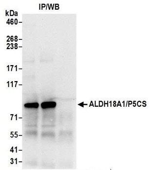 ALDH18A1/P5CS Antibody