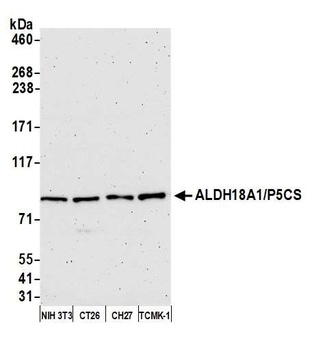 Rabbit anti-ALDH18A1/P5CS Antibody