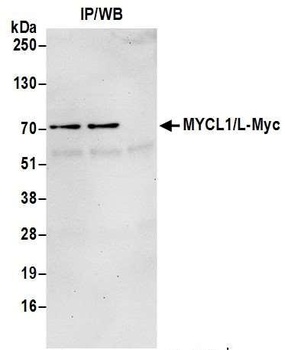 Rabbit MYCL1/L-Myc Antibody