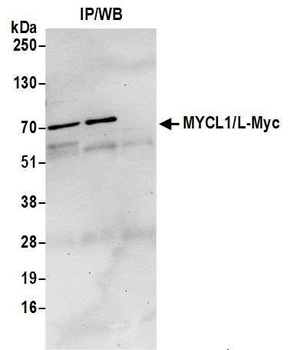 Rabbit MYCL1/L-Myc Antibody